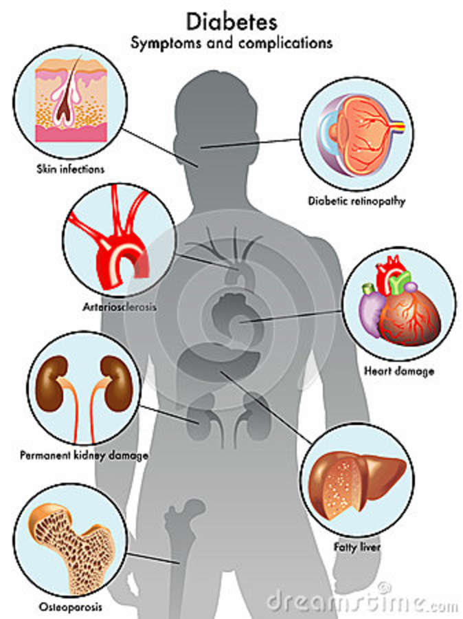 Diabete: sintomi e complicanze